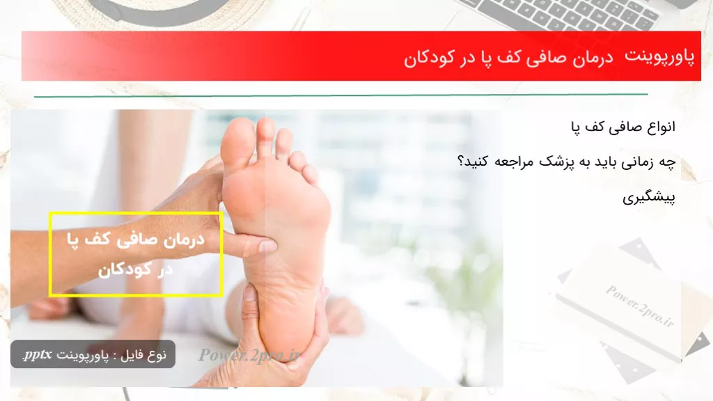 دانلود پاورپوینت درمان صافی کف پا در کودکان - کد102055