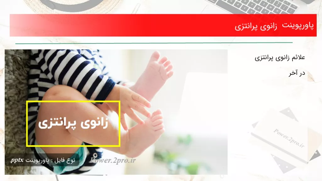 دانلود پاورپوینت زانوی پرانتزی - کد102081