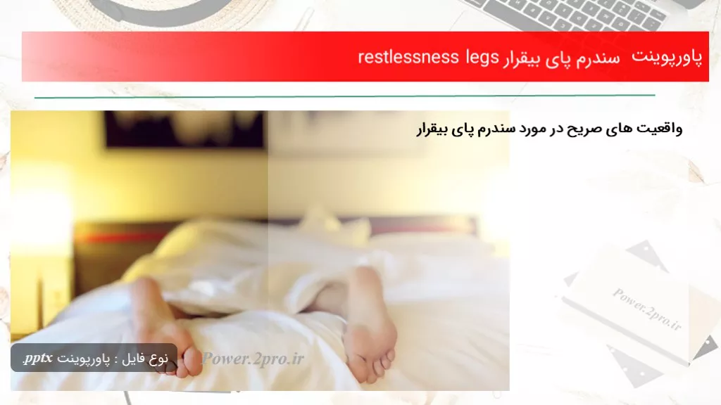 دانلود پاورپوینت سندرم پای بیقرار restlessness legs - کد102087