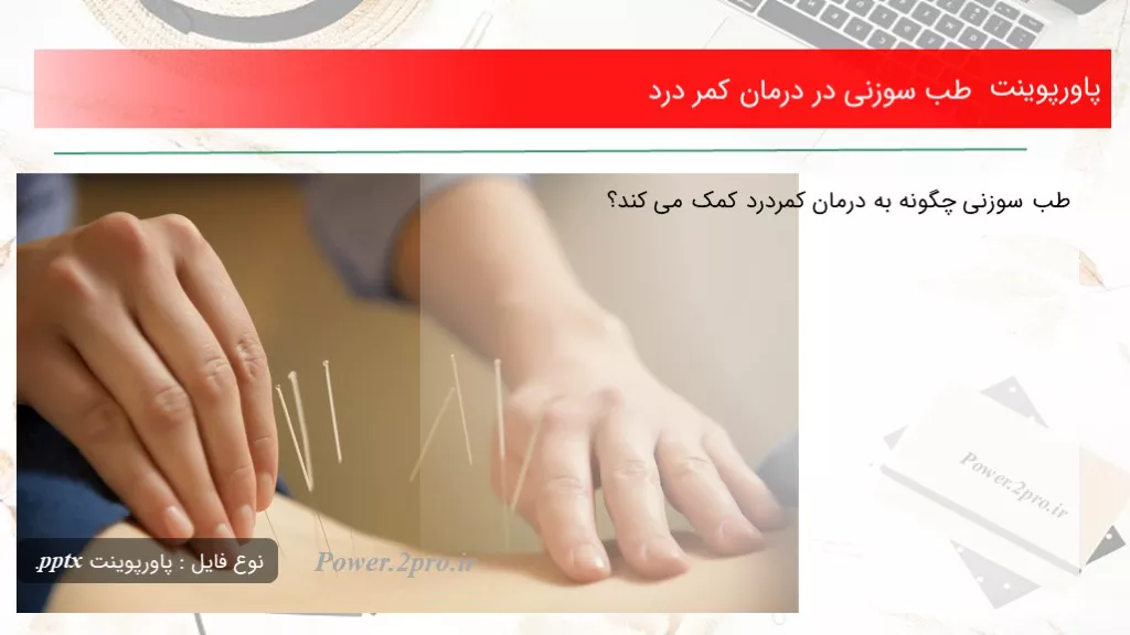 دانلود پاورپوینت طب سوزنی در درمان کمر درد - کد102105