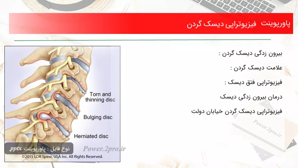 دانلود پاورپوینت فیزیوتراپی دیسک گردن - کد102166