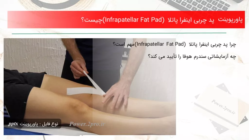 دانلود پاورپوینت پد چربی اینفرا پاتلا (Infrapatellar Fat Pad)  چه چیزی است ؟ - کد102265