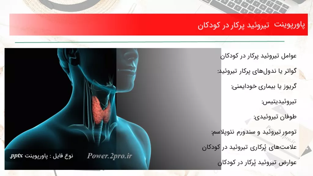 دانلود پاورپوینت تیروئید پرکار در کودکان - کد102443