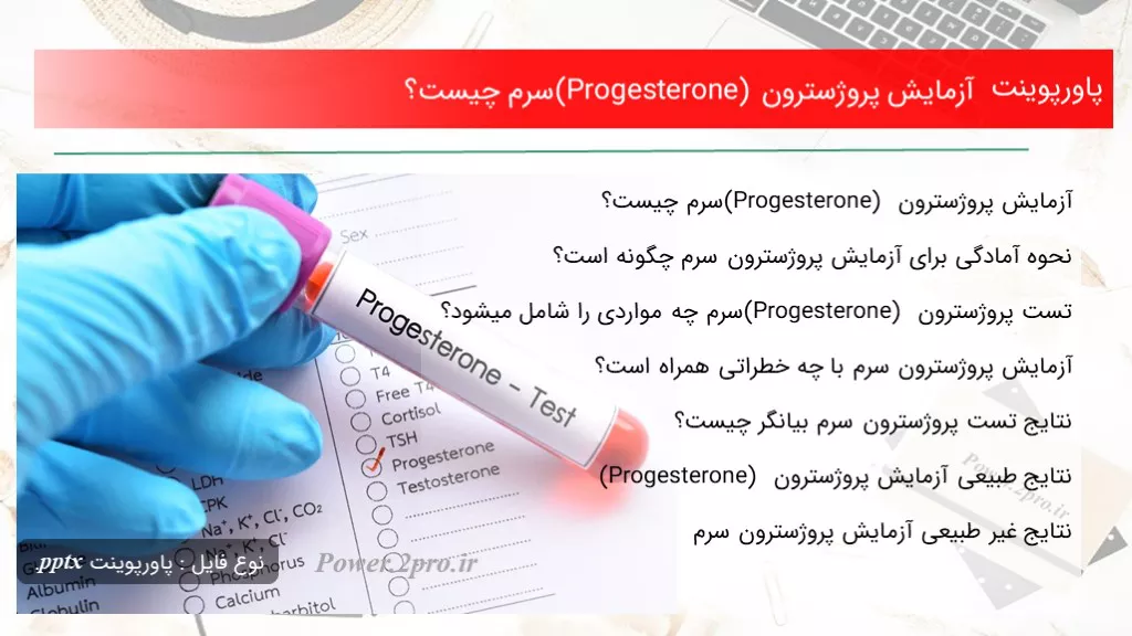 دانلود پاورپوینت آزمایش پروژسترون (Progesterone) سرم چه چیزی است ؟ - کد102574