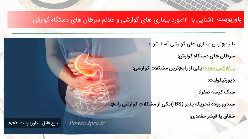 دانلود پاورپوینت آشنا شدن با با ۱۲ مورد بیماری های گوارشی و علائم سرطان های دستگاه گوارش - کد102608