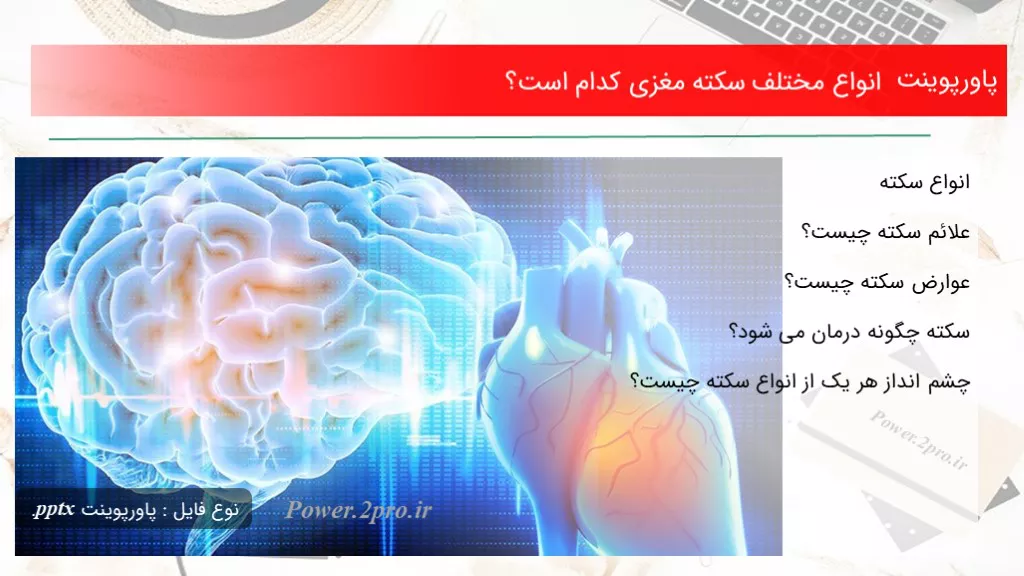 دانلود پاورپوینت انواع مختلف سکته مغزی کد ام است؟ - کد102619