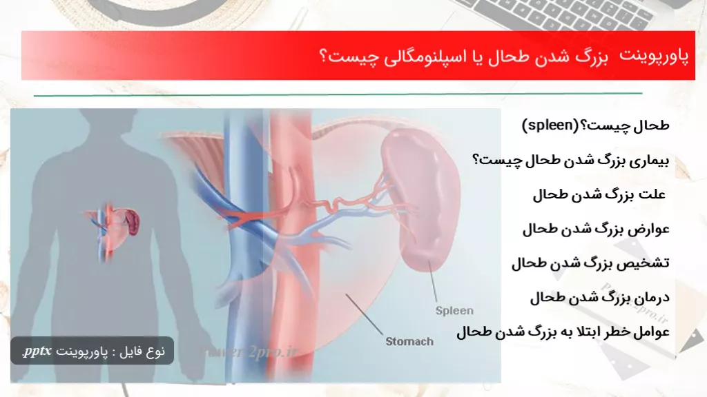 دانلود پاورپوینت بزرگ شدن طحال یا اسپلنومگالی چه چیزی است ؟ - کد102655