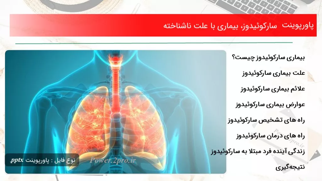 دانلود پاورپوینت سارکوئیدوز، بیماری با چرایی ناشناخته - کد102681