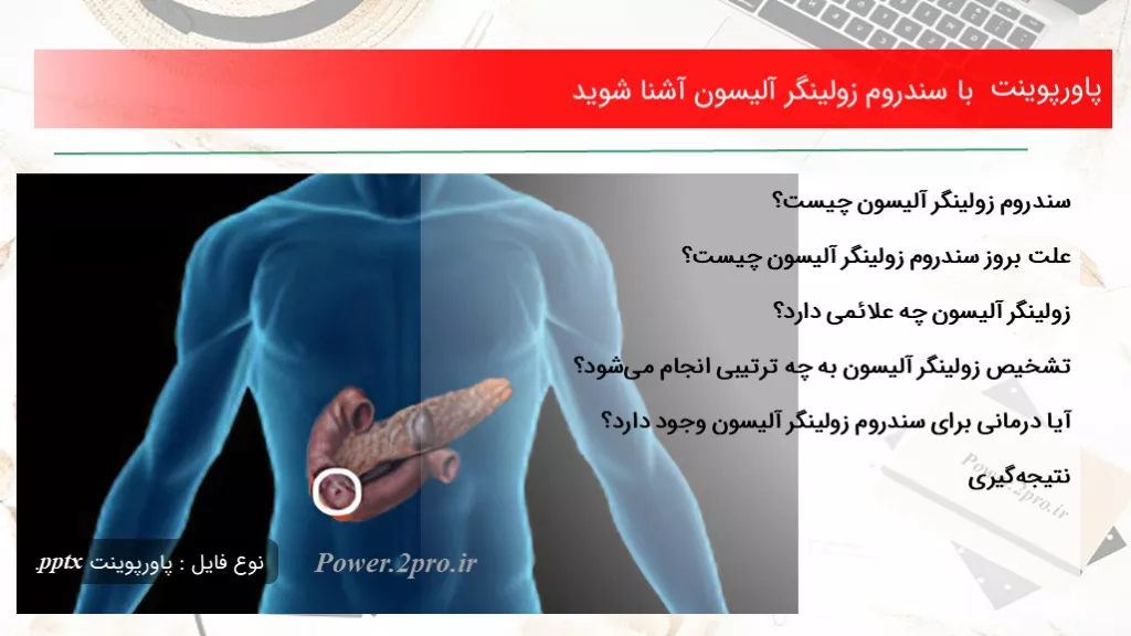 دانلود پاورپوینت با سندروم زولینگر آلیسون آشنا شوید - کد102688