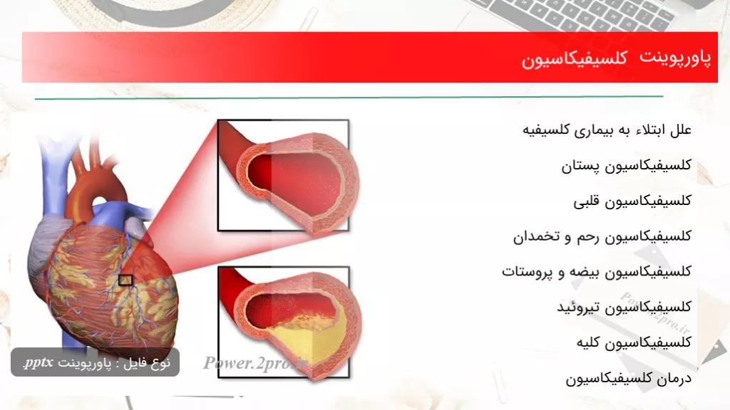 دانلود پاورپوینت کلسیفیکاسیون - کد103525