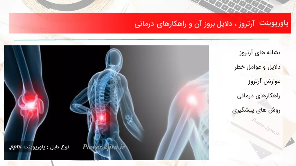 دانلود پاورپوینت آرتروز ، دلایل بروز آن و راهکارهای درمانی - کد104767