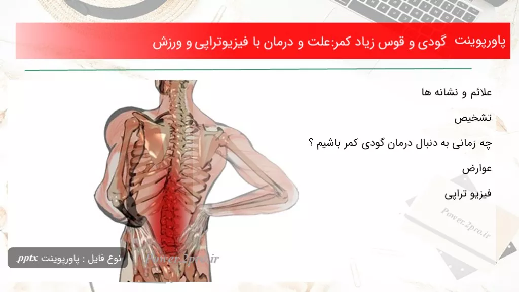 گودی و قوس زیاد کمر:علت و درمان با فیزیوتراپی و ورزش