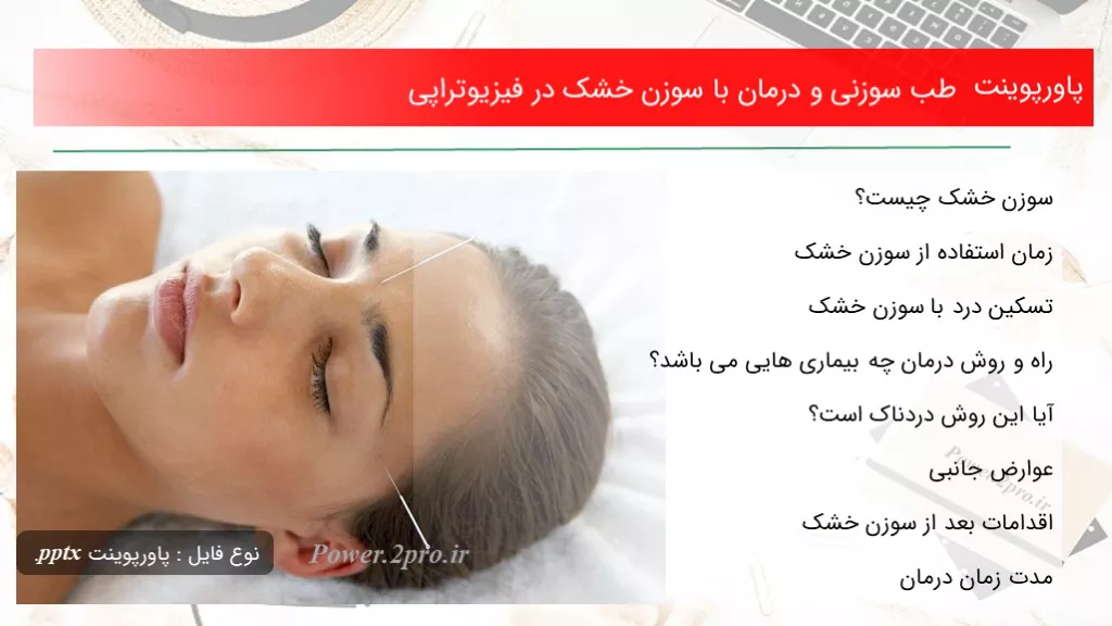 طب سوزنی و درمان با سوزن خشک در فیزیوتراپی