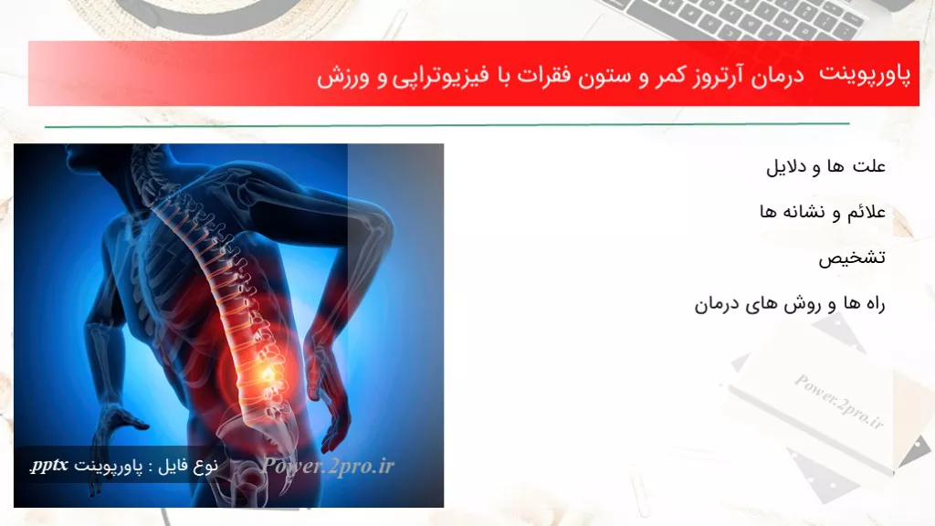 دانلود پاورپوینت درمان آرتروز کمر و ستون فقرات با فیزیوتراپی و ورزش - کد105019