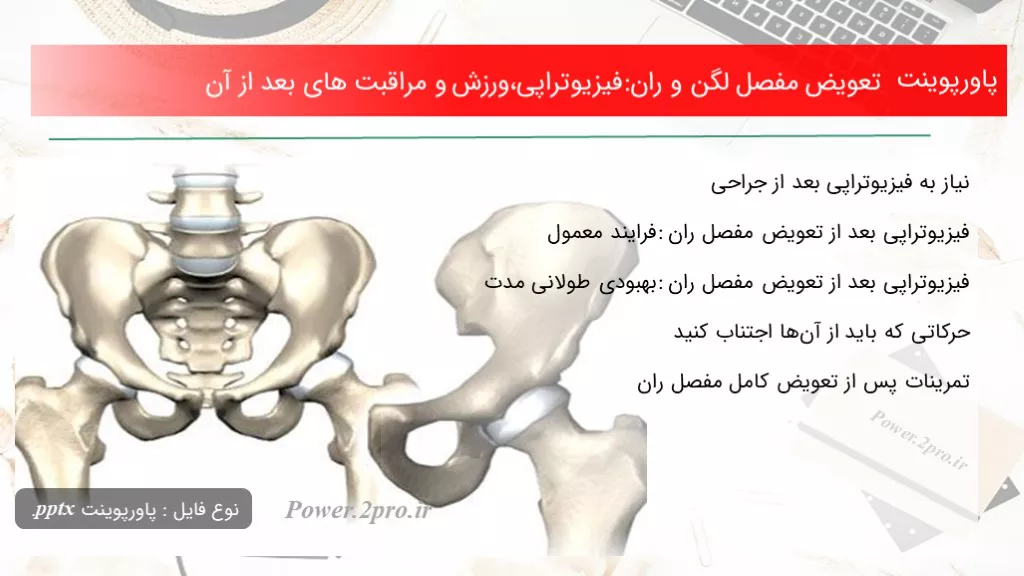 تعویض مفصل لگن و ران:فیزیوتراپی،ورزش و مراقبت های بعد از آن