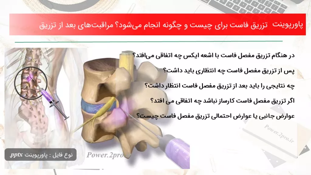 دانلود پاورپوینت تزریق فاست به منظور چه چیزی است و چطور انجام می‌شود؟ مراقبت‌های بعد از تزریق - کد105042