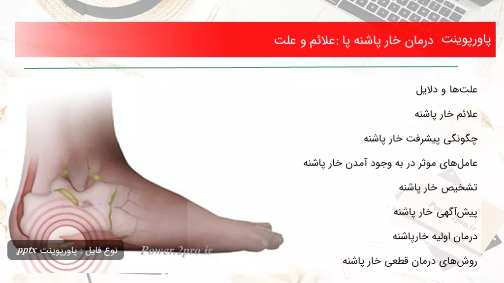 دانلود پاورپوینت درمان خار پاشنه پا: علائم و چرایی - کد105045