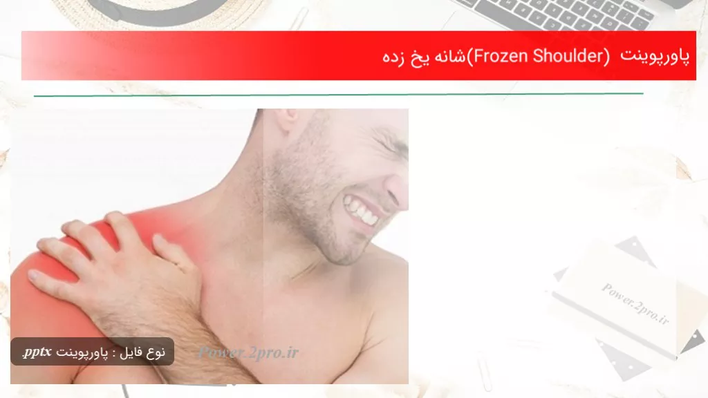 دانلود پاورپوینت (Frozen Shoulder)شانه یخ زده - کد105077