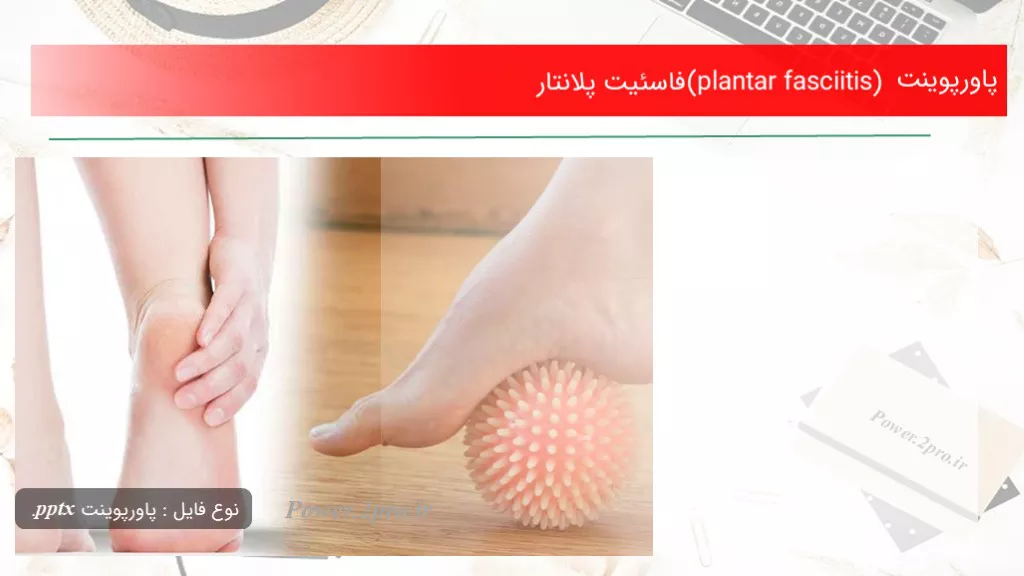 دانلود پاورپوینت (plantar fasciitis)فاسئیت پلانتار - کد105085