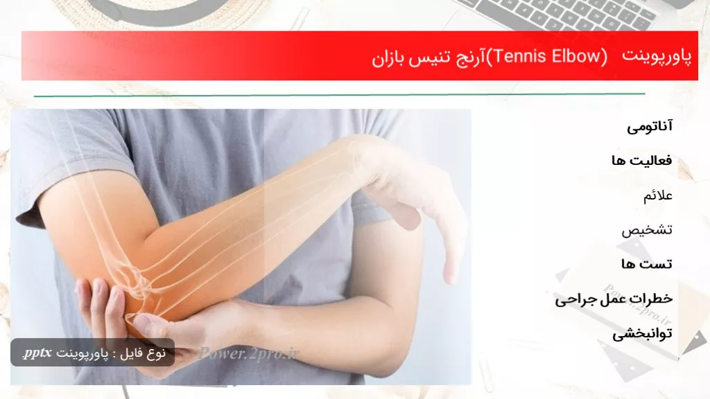 (Tennis Elbow) آرنج تنیس بازان