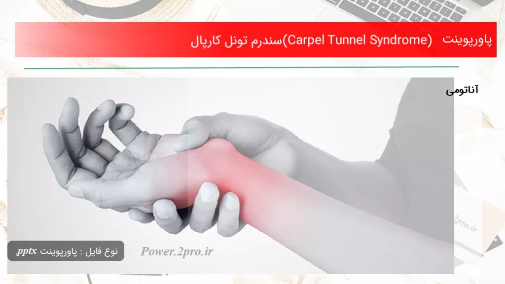 (Carpel Tunnel Syndrome) سندرم تونل کارپال