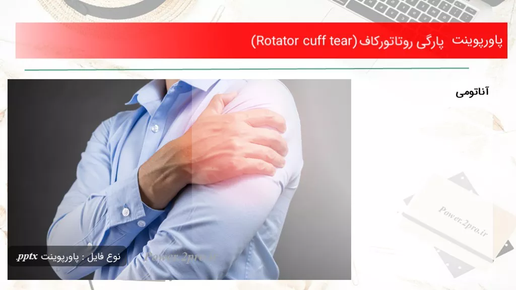 دانلود پاورپوینت پارگی روتاتورکاف (Rotator cuff tear) - کد105112