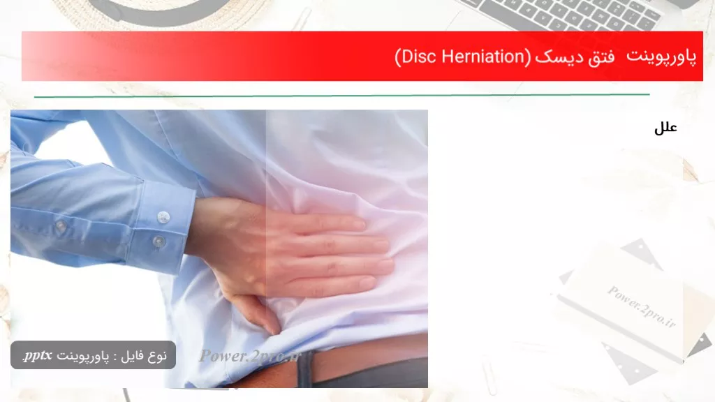 دانلود پاورپوینت فتق دیسک (Disc Herniation) - کد105118