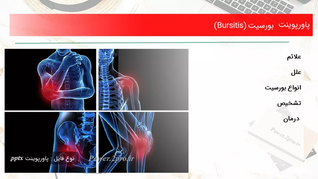 دانلود پاورپوینت بورسیت (Bursitis) - کد105131