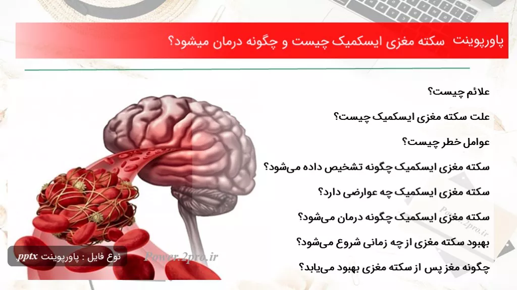 سکته مغزی ایسکمیک چیست و چگونه درمان میشود؟