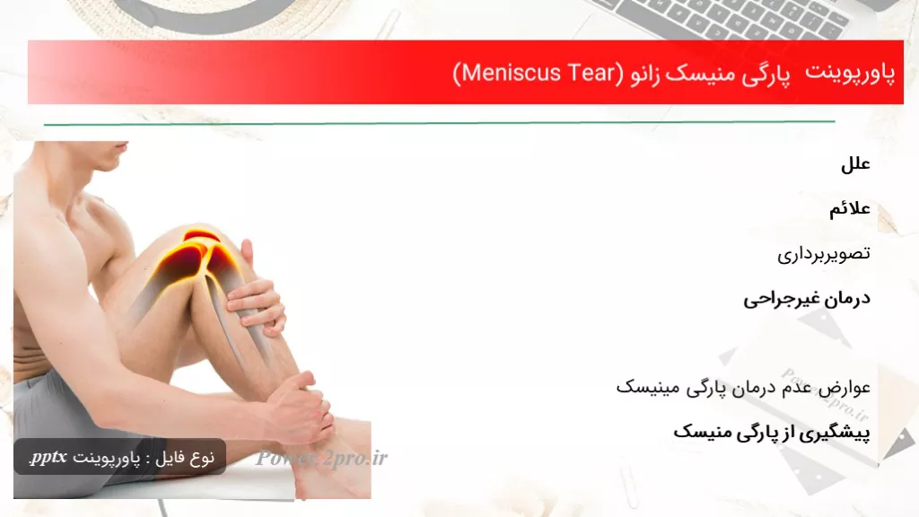 دانلود پاورپوینت پارگی منیسک زانو (Meniscus Tear) - کد105139