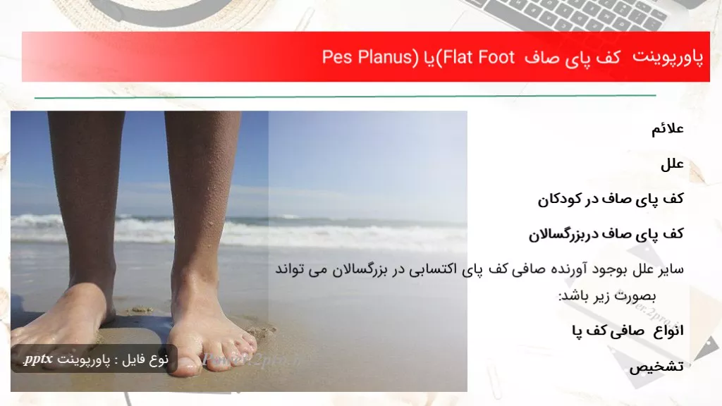 دانلود پاورپوینت کف پای صاف (Flat Foot یا Pes Planus) - کد105141