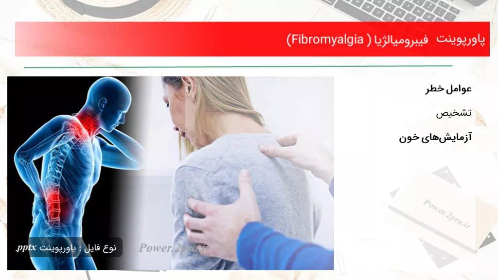 دانلود پاورپوینت فیبرومیالژیا (Fibromyalgia ) - کد105145