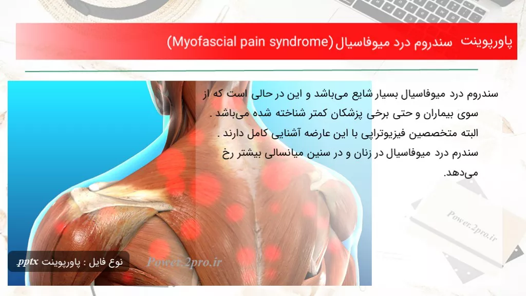 دانلود پاورپوینت سندروم درد میوفاسیال (Myofascial pain syndrome) - کد105155