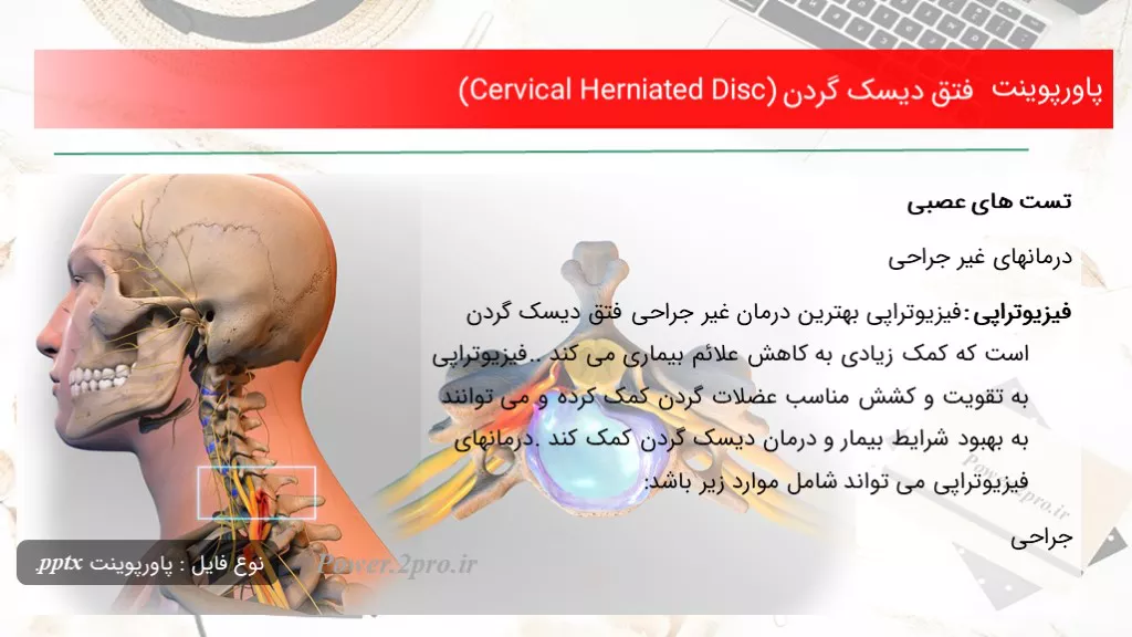 فتق دیسک گردن (Cervical Herniated Disc)