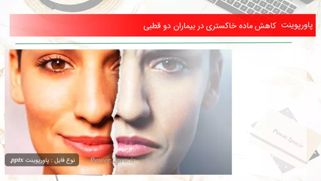 دانلود پاورپوینت افت ماده خاکستری در بیماران دو قطبی - کد105177