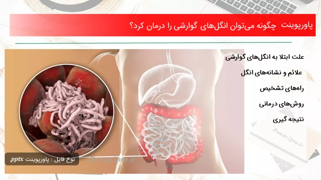 دانلود پاورپوینت چطور می‌توان انگل‌های گوارشی را درمان کرد؟ - کد105179