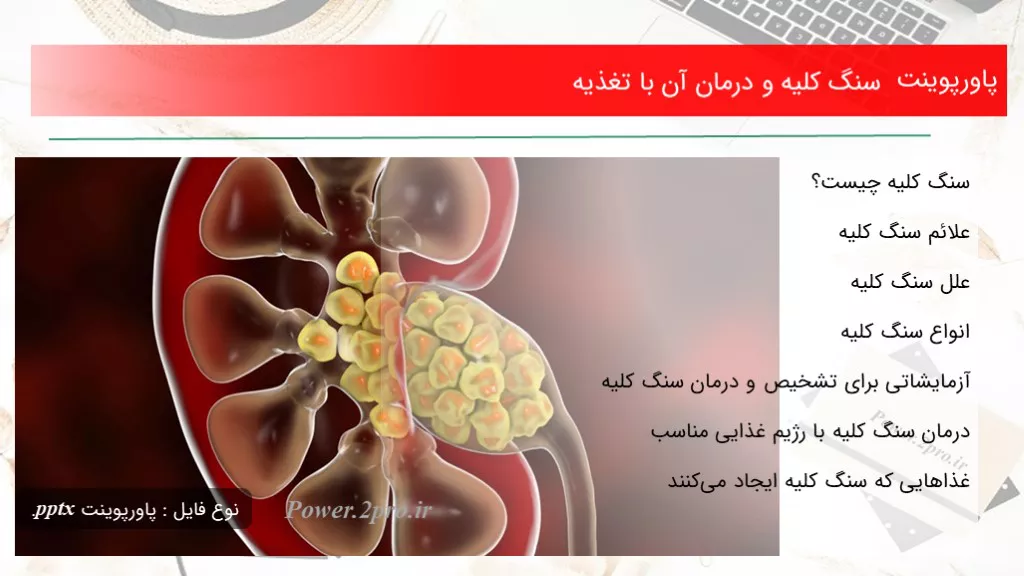 دانلود پاورپوینت سنگ کلیه و درمان آن با تغذیه - کد105342