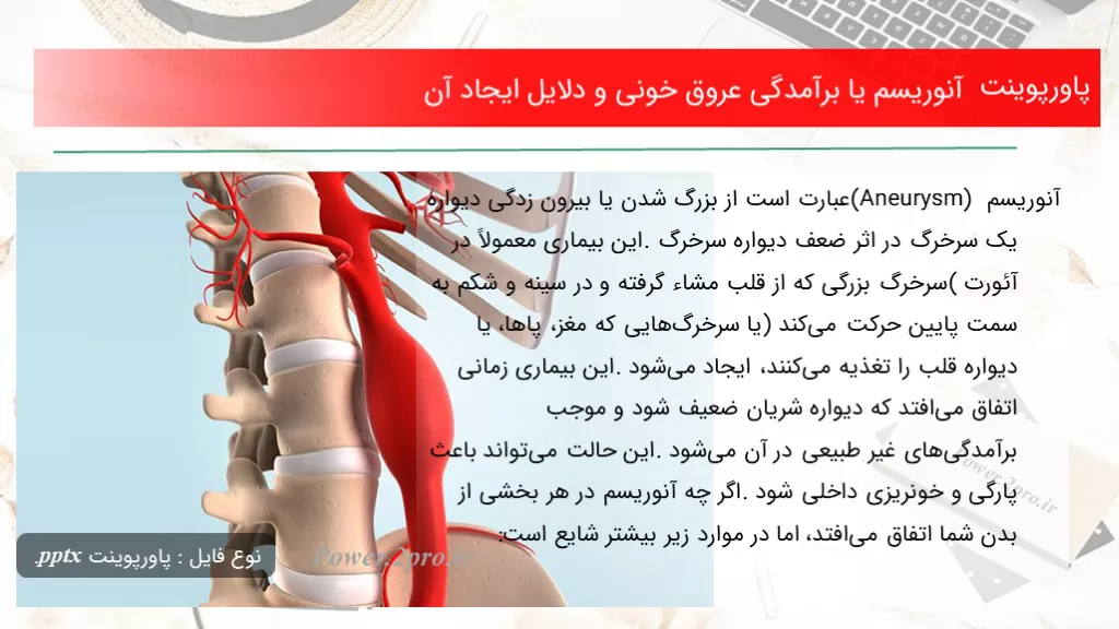 دانلود پاورپوینت آنوریسم یا برآمدگی عروق خونی و دلایل ایجاد آن - کد105641