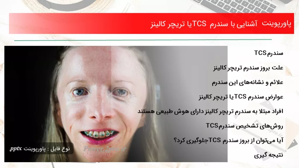 دانلود پاورپوینت آشنا شدن با با سندرم TCS یا تریچر کالینز - کد105651