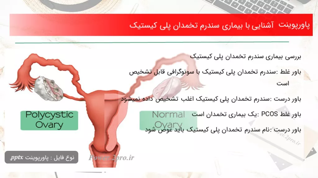 آشنایی با بیماری سندرم تخمدان پلی کیستیک