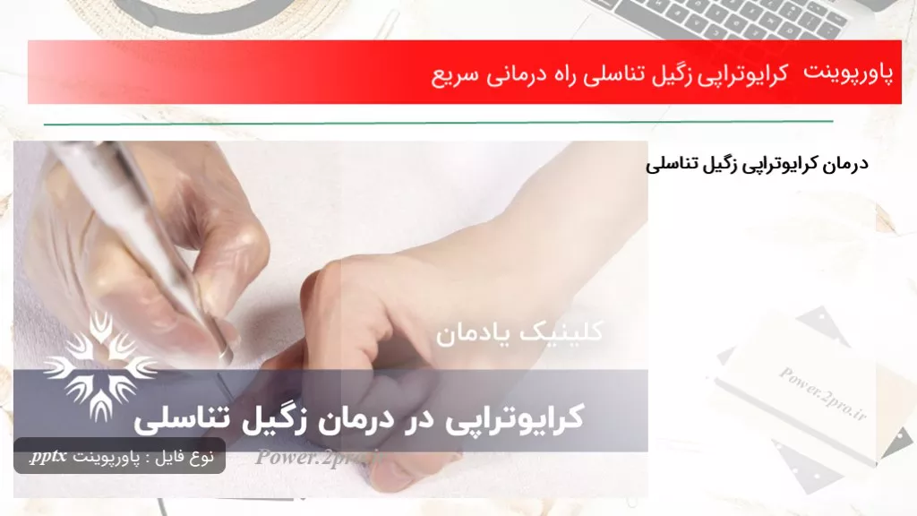 دانلود پاورپوینت کرایوتراپی زگیل تناسلی راه درمانی سریع - کد106339