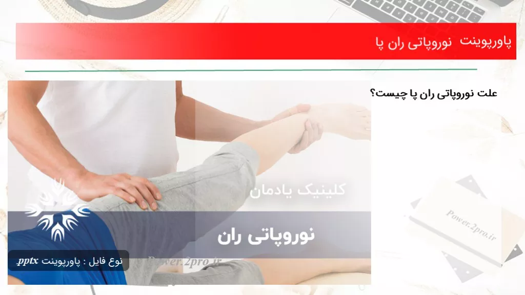 دانلود پاورپوینت نوروپاتی ران پا - کد106377