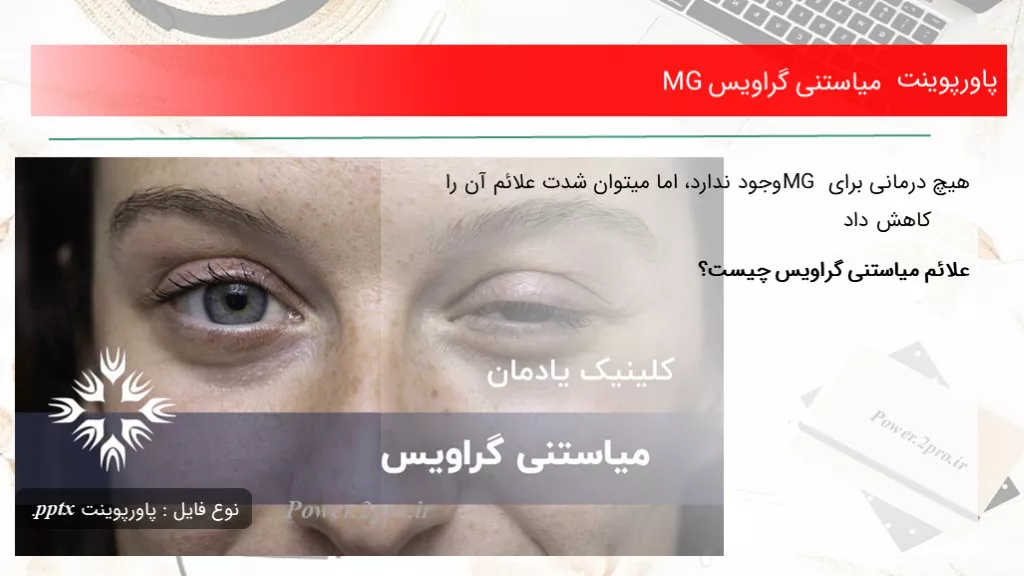 دانلود پاورپوینت میاستنی گراویس MG - کد106402