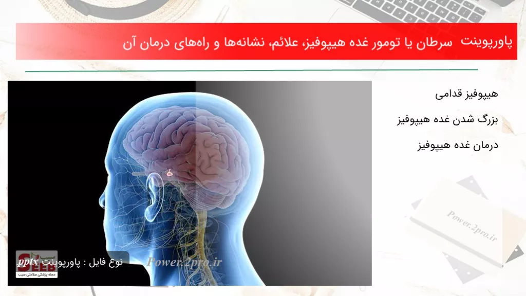 دانلود پاورپوینت سرطان یا تومور غده هیپوفیز، علائم، آثار و راه‌های درمان آن - کد106475