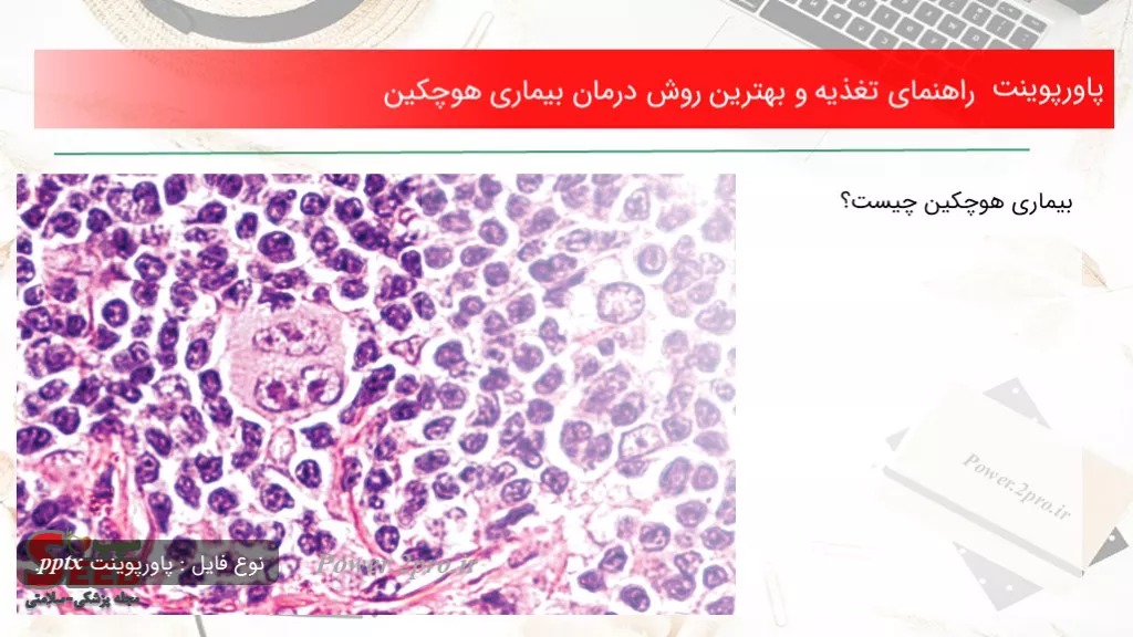 دانلود پاورپوینت راهنمای تغذیه و بهترین چگونگی درمان بیماری هوچکین - کد106489