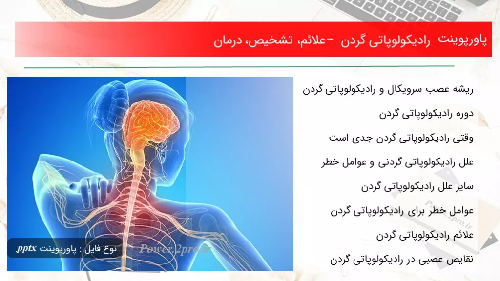 دانلود پاورپوینت رادیکولوپاتی گردن – علائم، تشخیص، درمان - کد106491