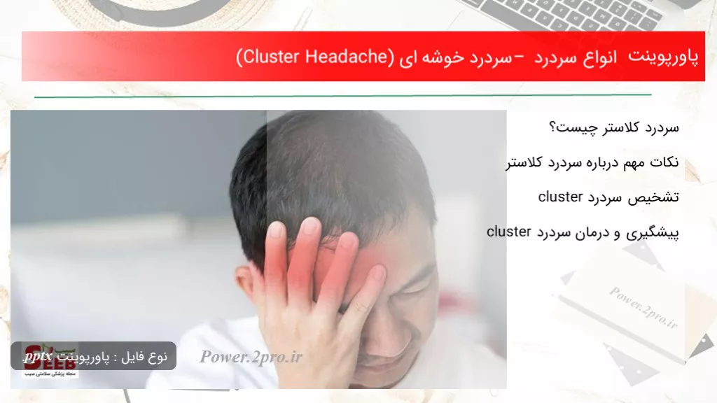 دانلود پاورپوینت انواع سردرد – سردرد خوشه ای (Cluster Headache) - کد106590