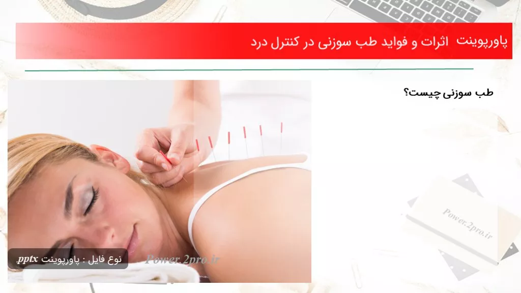 دانلود پاورپوینت اثرات و فواید طب سوزنی در کنترل درد - کد106615