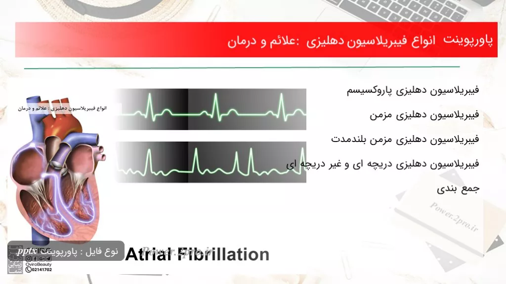 دانلود پاورپوینت انواع فیبریلاسیون دهلیزی : علائم و درمان - کد106684