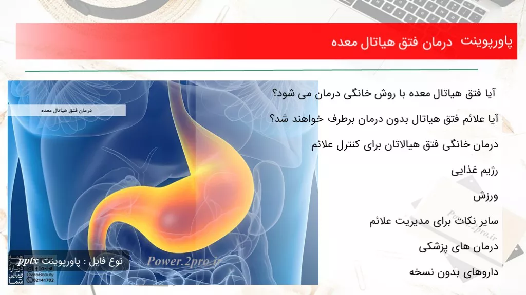 دانلود پاورپوینت درمان فتق هیاتال معده - کد106715